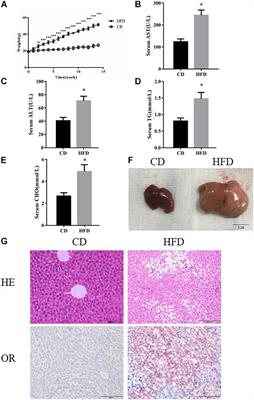 Protective Properties of FOXO1 Inhibition in a Murine Model of Non-alcoholic Fatty Liver Disease Are Associated With Attenuation of ER Stress and Necroptosis